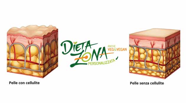 dieta zona cellulite
